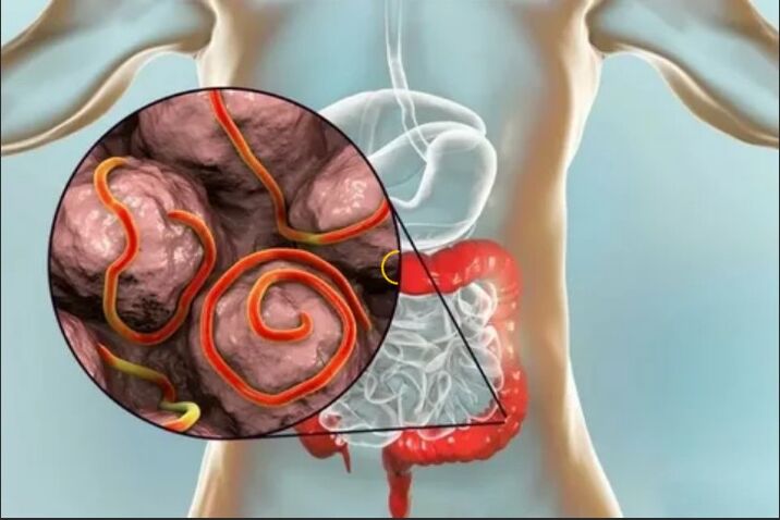 Parasites in the human body