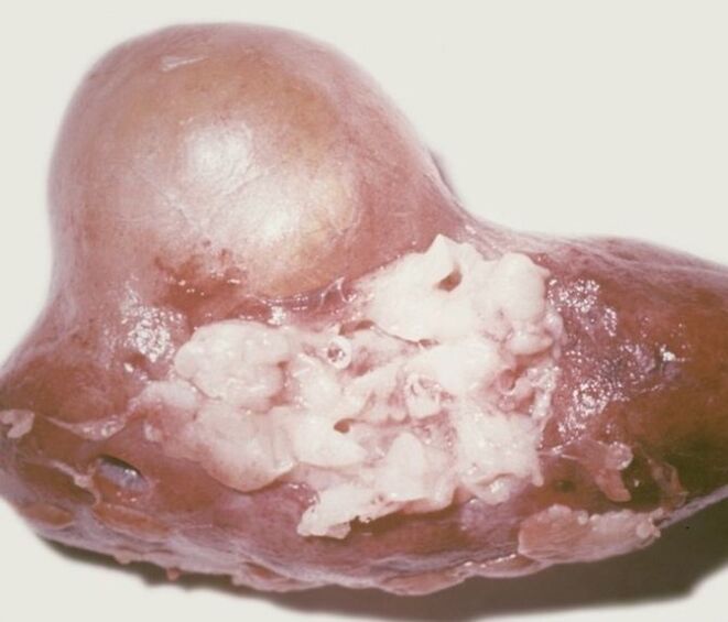 What are parasites